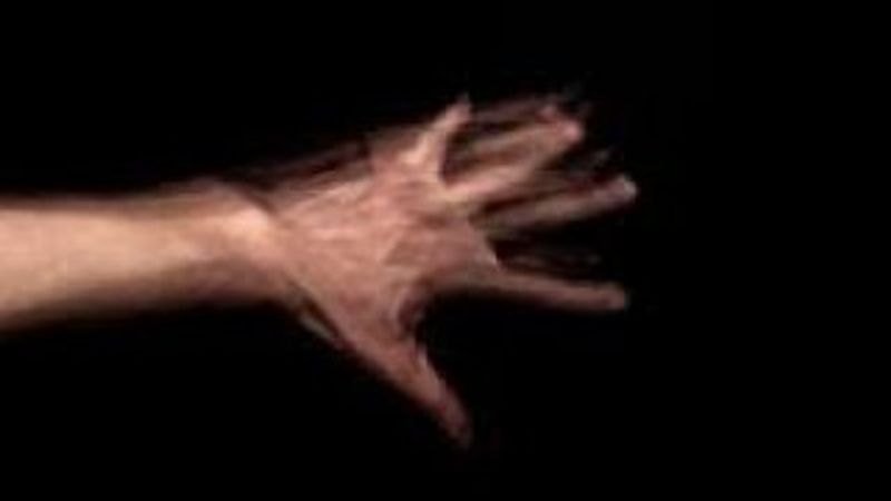 Yabancı el sendromu nedir