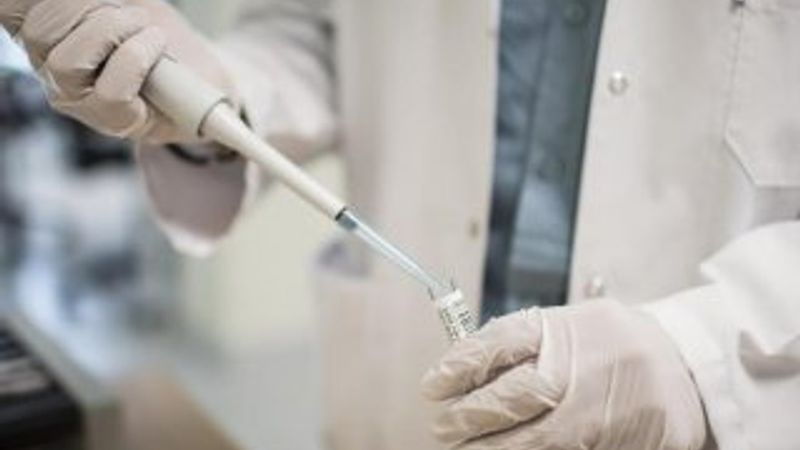 İTÜ'de yapay damar tasarlandı