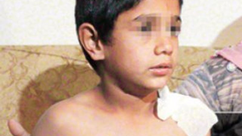 Suriyeli çocuğa sıcak su döken çalışan hakkında karar