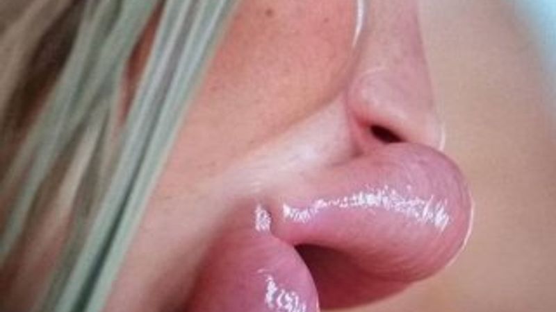 Estetik bağımlısı kadın pes dedirtti