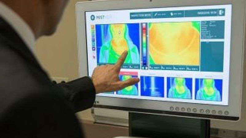 Mide kanserinin teşhisinde yapay zeka