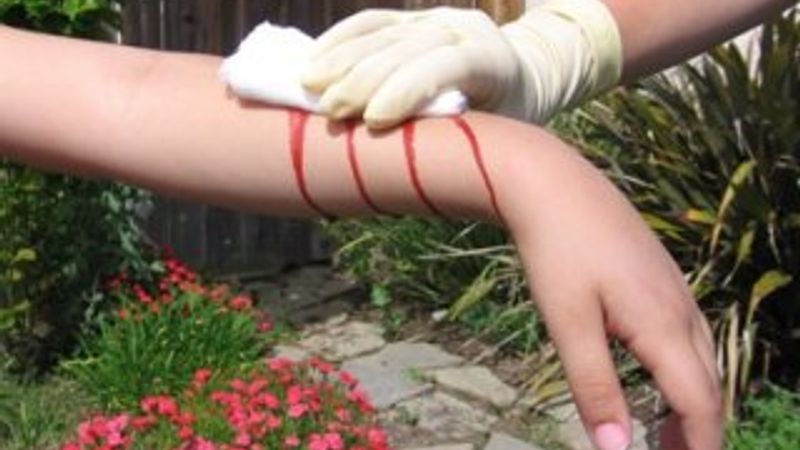 Hemofili hastalarının çaresiz bekleyişi