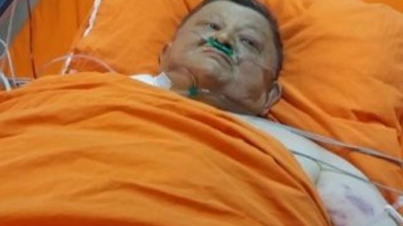 Şişko Nuri lakaplı Sezgin yoğun bakımda