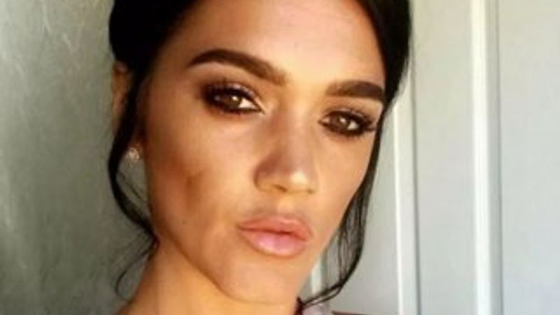 İngiliz kadın kalça büyütme operasyonunda yaşamını yitirdi