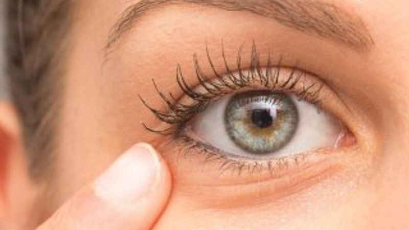 Göz enfeksiyonu nedir