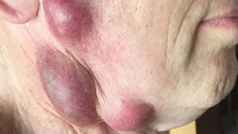 ABD'li yaşlı adam kedisinden ölümcül bakteri kaptı