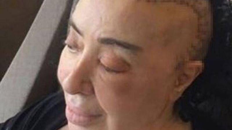 Nur Yerlitaş'tan operasyon sonrası fotoğraf