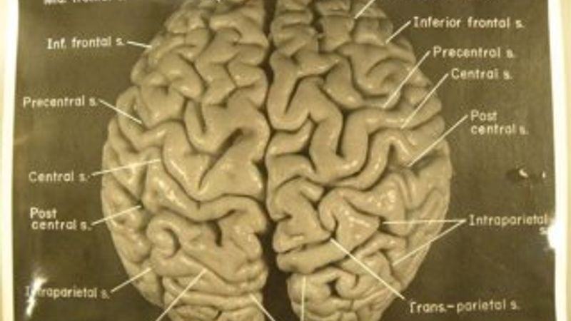Einstein’ın beyninin trajikomik bir hikayesi var