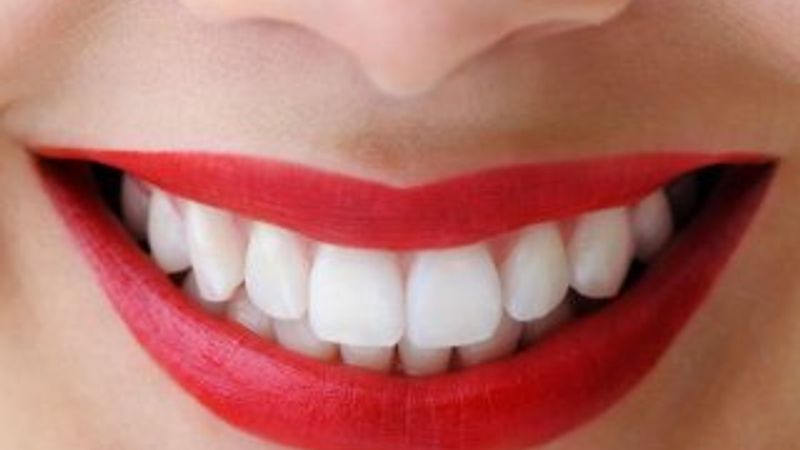 Sağlıklı dişler için bunları yapmayın