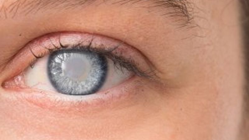 Diyabet göz hastalıklarını tetikliyor