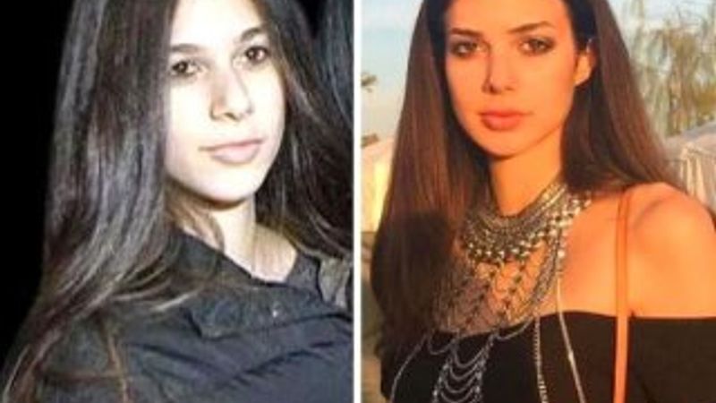 Estetiksiz Deren Talu