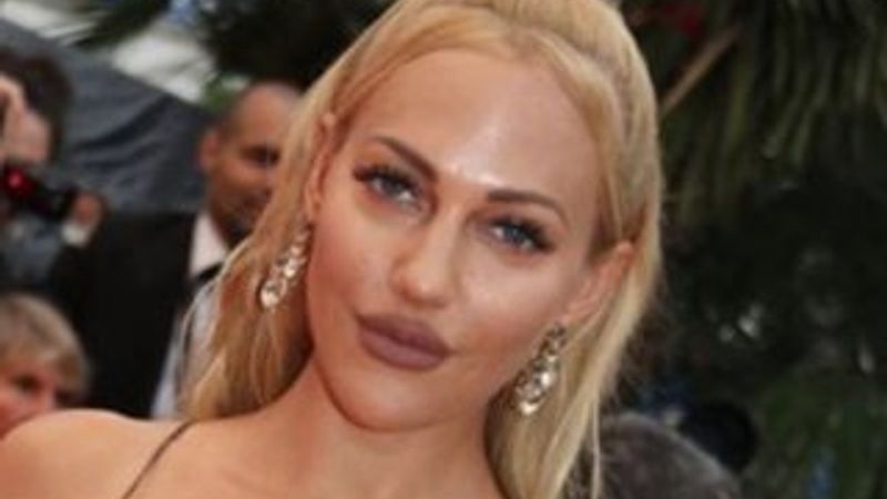 Meryem Uzerli dolgularını aldırıyor
