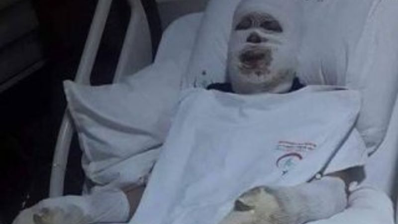 Milletin duası Mehmetçik ile beraber