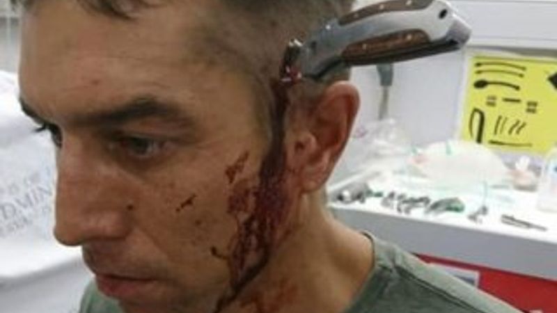 Başına saplı bıçakla yaşam mücadelesi verdi