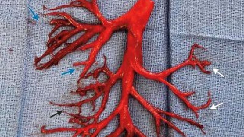 Ciğerleri ağzından geldi