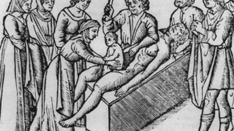 Sezaryen doğumun ilginç tarihçesi