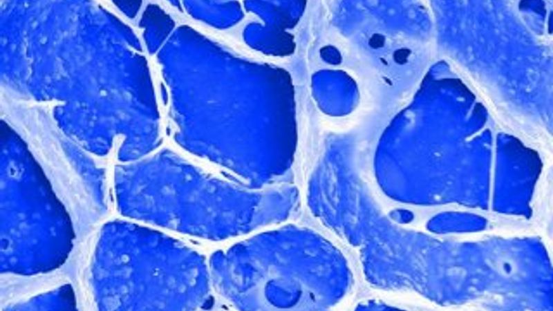 Kanseri önleyen yeni bir sprey geliştirildi