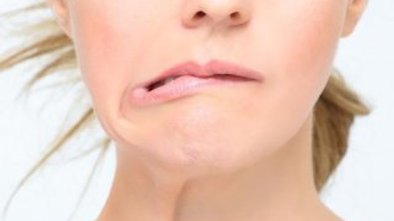 Soğuklar yüz felcine neden oluyor