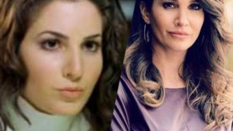 Rojda Demirer'den estetik açıklaması