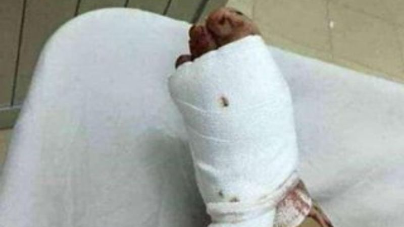 Yatak fantezisi yüzünden canından oluyordu