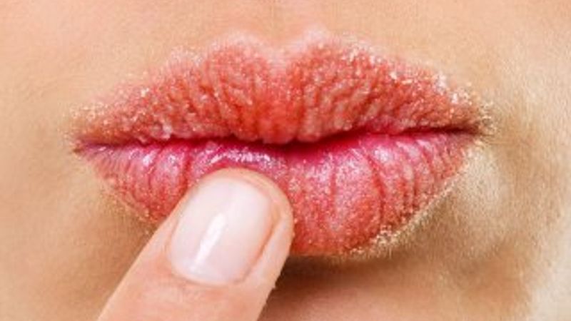 Yüzdeki değişiklikler hastalık belirtisi olabilir