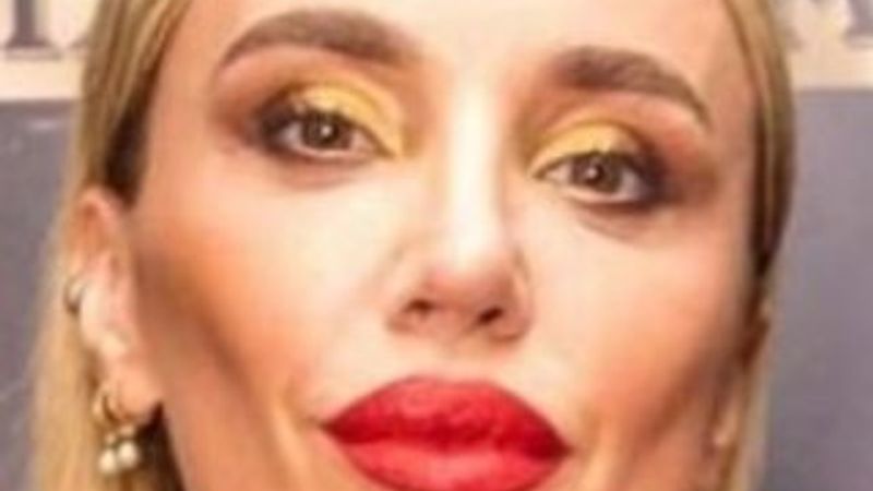 Gülşen'in yüzündeki değişiklik