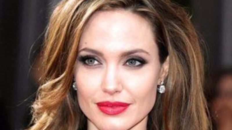 Hollywood yanağı nedir