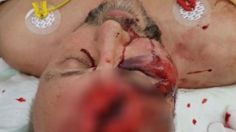 Almanya'da AfD milletvekili öldüresiye dövüldü