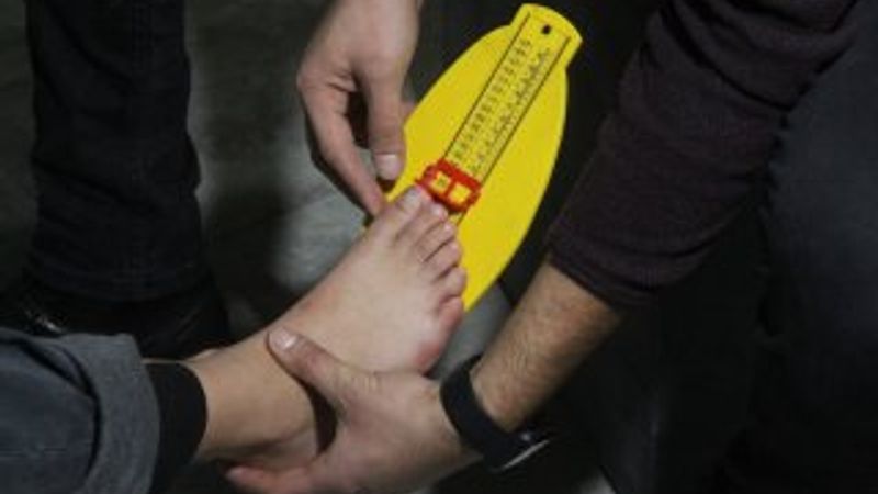 24 parmaklı çocuğa devletten özel ayakkabı