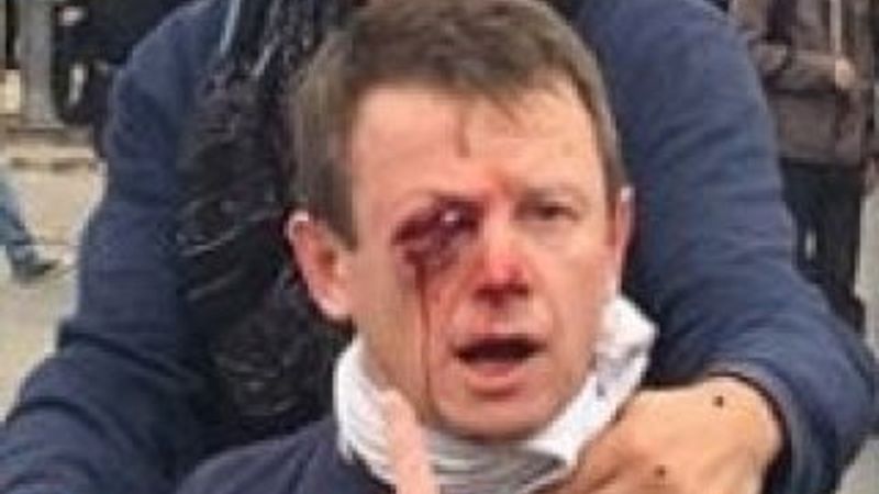 Fransa'da plastik mermi kullanımına devam kararı