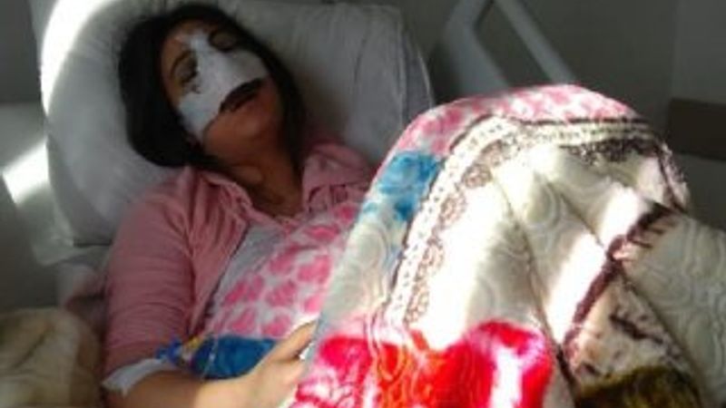 Burun ameliyatına giren Leyla hayatını kaybetti