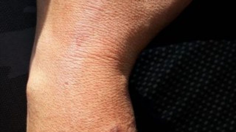 Pankartını vermek istemeyen HDP'li polisi ısırdı