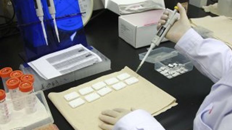 Kök hücre yöntemiyle AIDS tedavi edildi