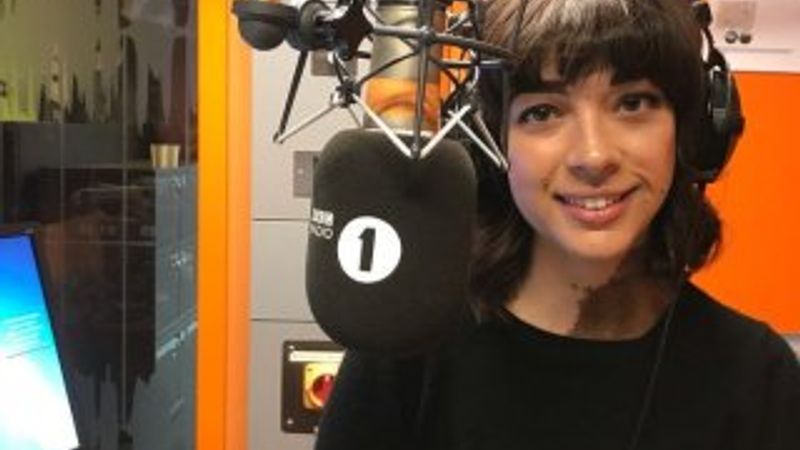 İngiliz kadının ilginç hastalığı