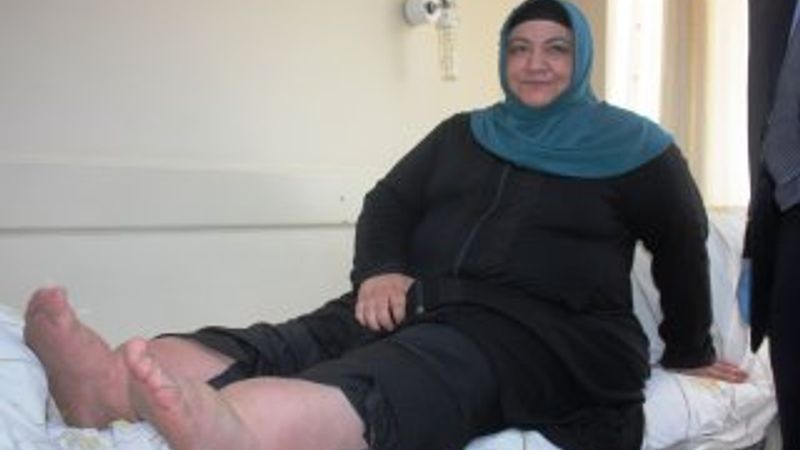 Zayıflamak isterken hayatından oluyordu