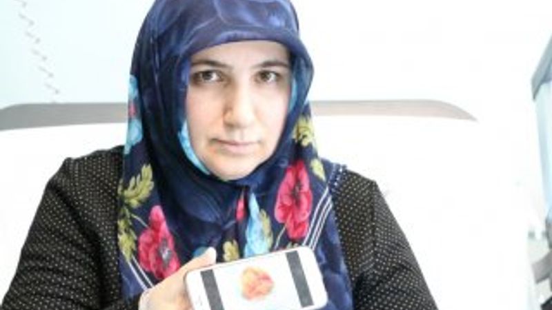 Talihsiz kadının kalbinden kitle çıkarıldı