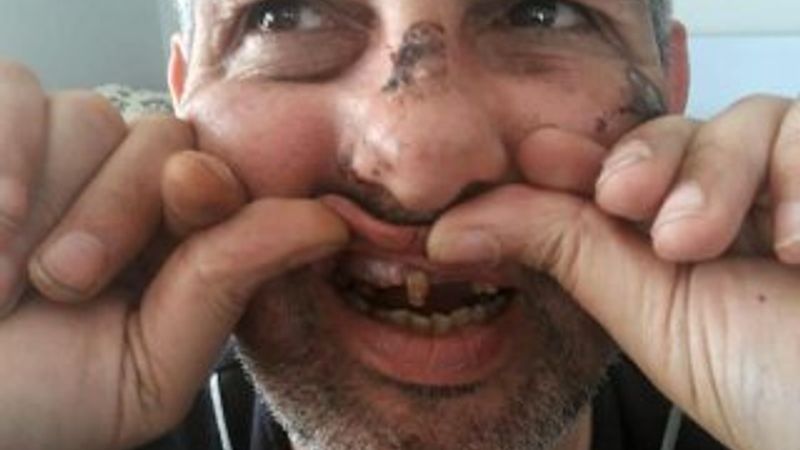 İstediklerine ret cevabı verince 6 Suriyeli darbetti