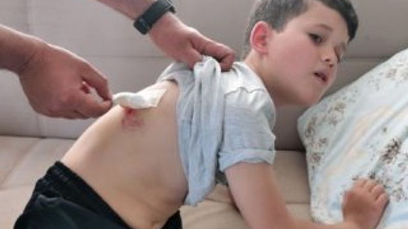 Bursa'da 9 yaşındaki çocuğa sokak köpekleri saldırdı