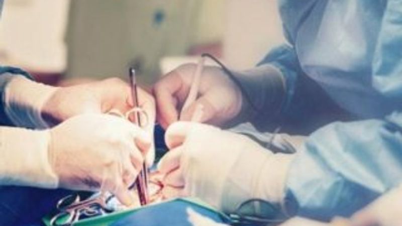 Videotorakoskopi nedir