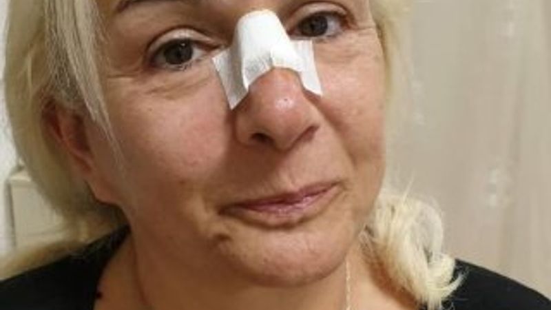 Burçin Orhon sevenlerini korkuttu