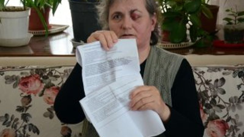 Gözünden aldırdığı et parçası hayatını kararttı