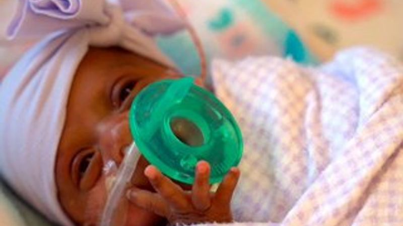 Dünyanın en küçük bebeği taburcu oldu