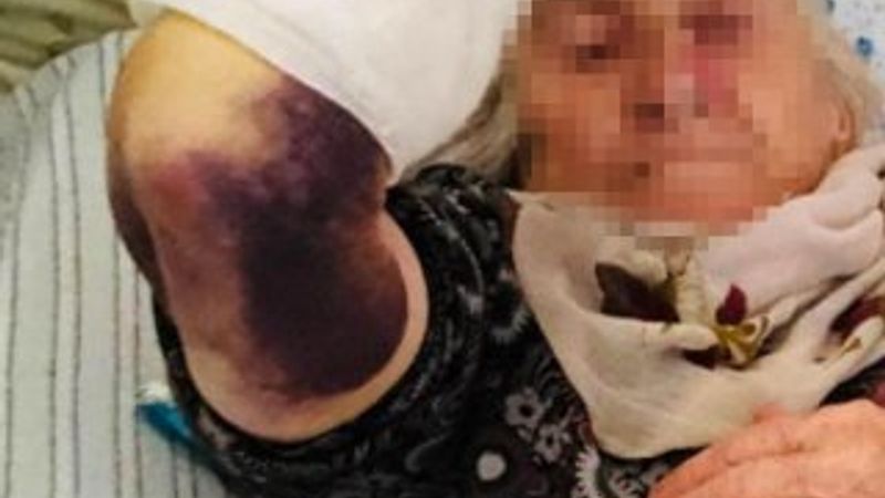 Alacak yüzünden 92 yaşındaki kayınvalidesini dövdü