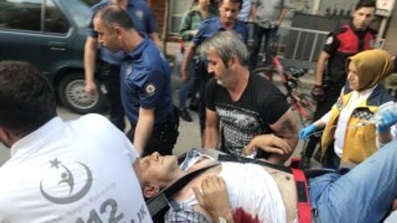 Miras yüzünden kardeşini yaraladı