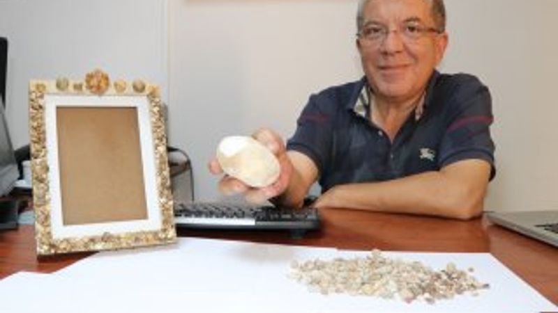 Hastalarından çıkardığı taşları koleksiyon yaptı