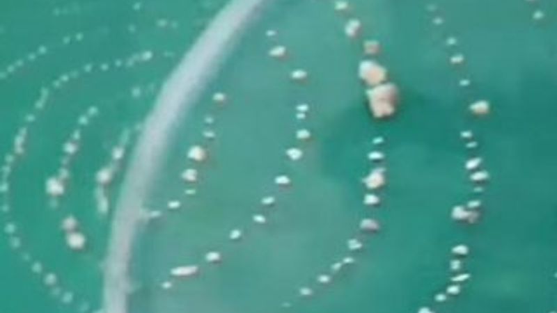 Hindistan'da 526 dişe sahip çocuk