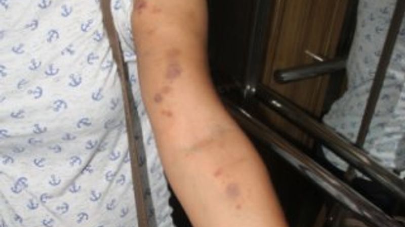 Adanalı kadın birlikte yaşadığı adam tarafından dövüldü