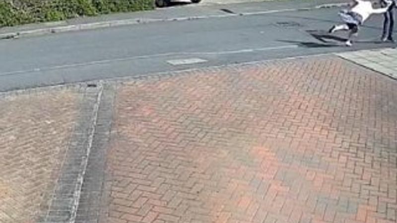 İngiltere'de kapkaççılar yüzünden kolunu kıran kadın