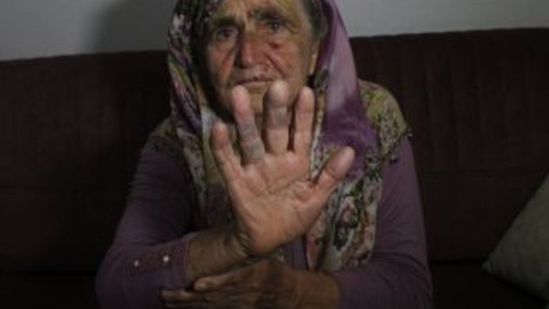 80 yaşındaki kadını darbeden zanlı savcıdan kurtulamadı