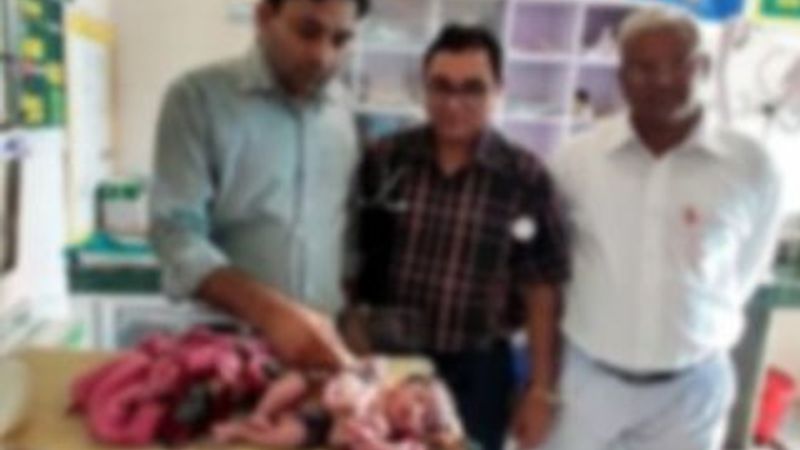 Hindistan'da dört bacaklı ve 3 kollu bir çocuk doğdu